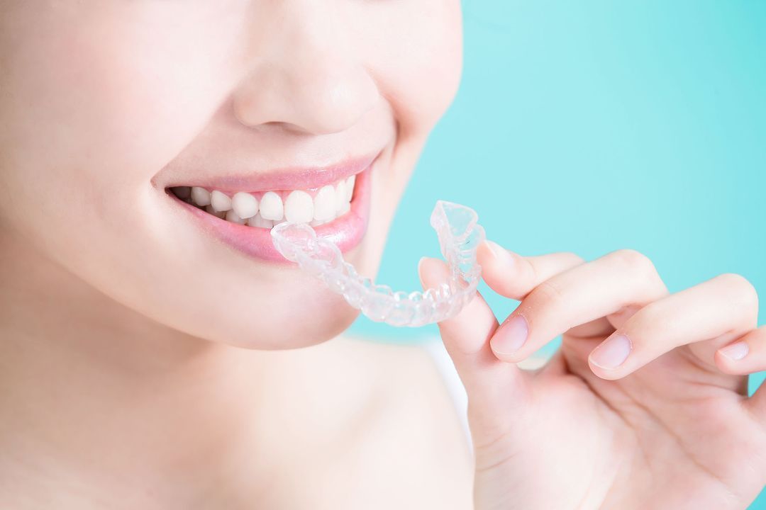 About the Invisalign Aligner System